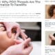 Aesthetic Island Press - Why PDO Threads Are The New Alternative To Facelifts