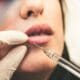 Botox v. Dysport — What’s the Difference