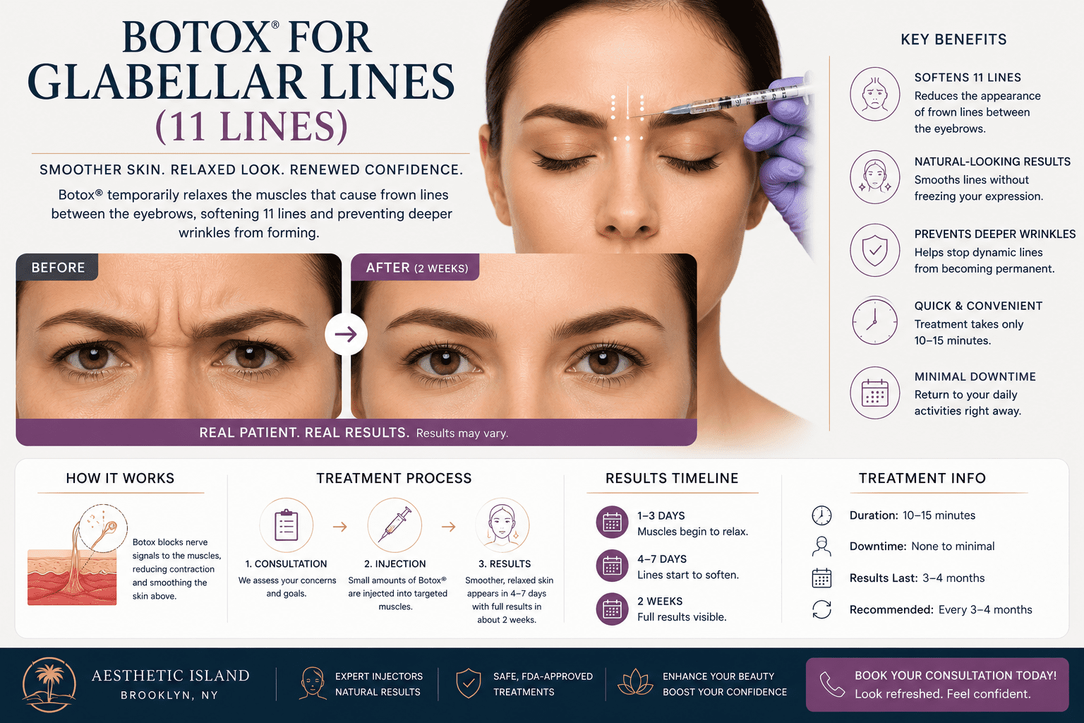 Botox for Glabellar Lines (11 Lines): Everything You Need to Know