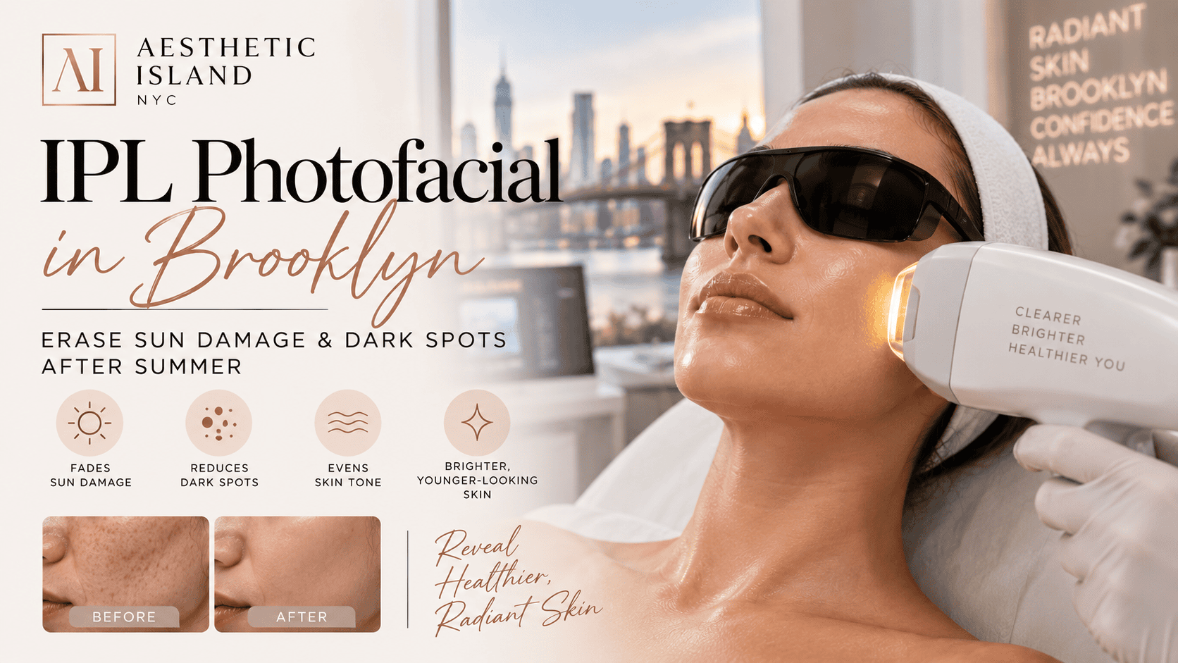 IPL Photofacial in Brooklyn Erase Sun Damage & Dark Spots After Summer