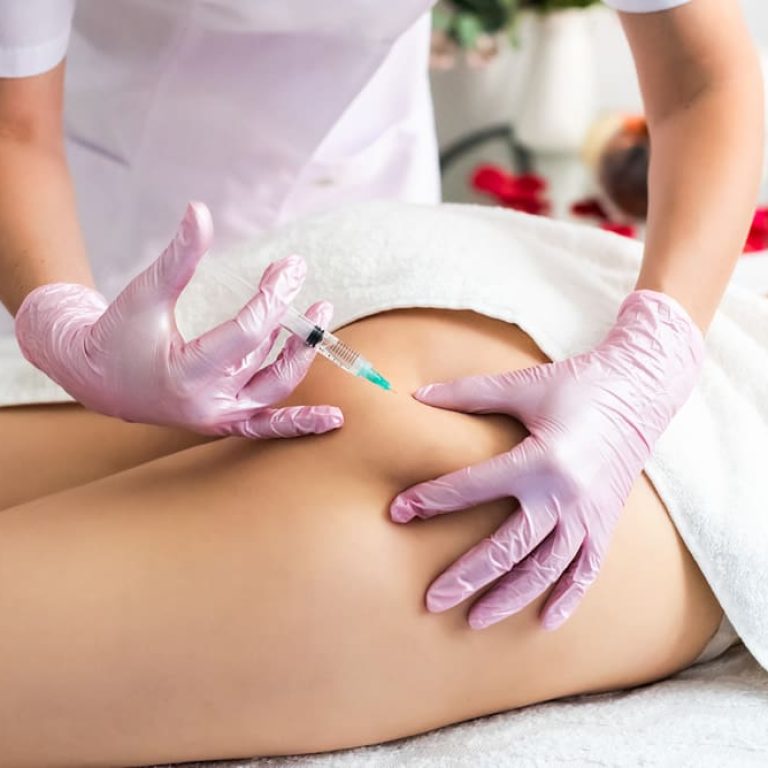 How Long Does a Non-Surgical BBL Last