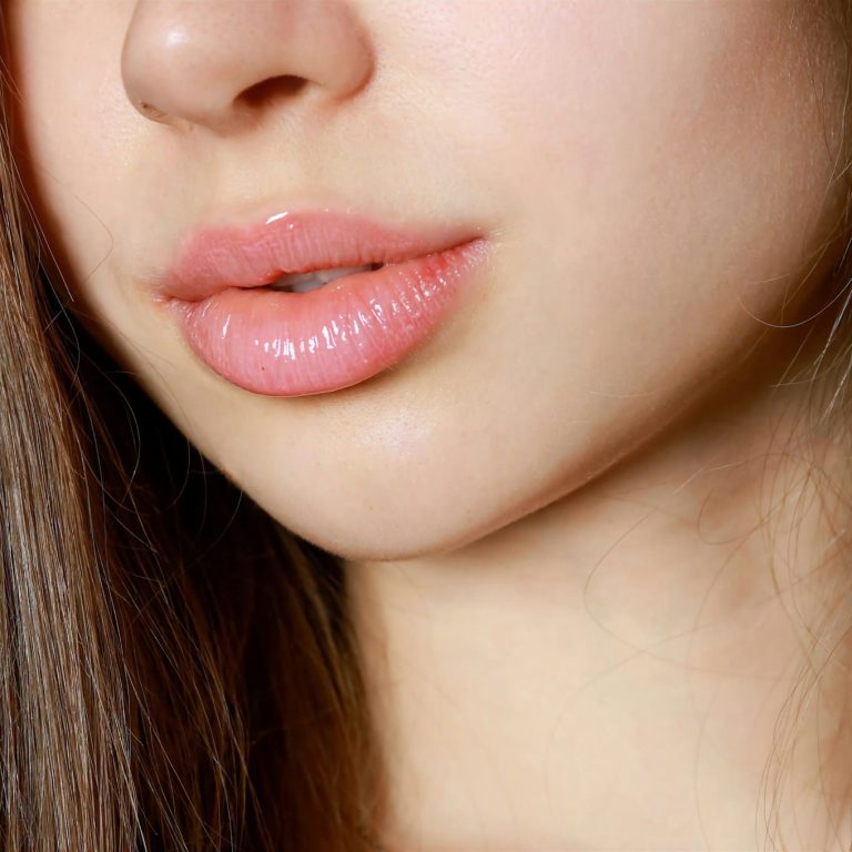 Lip Filler in Brooklyn Top Trends, Costs & Natural Results