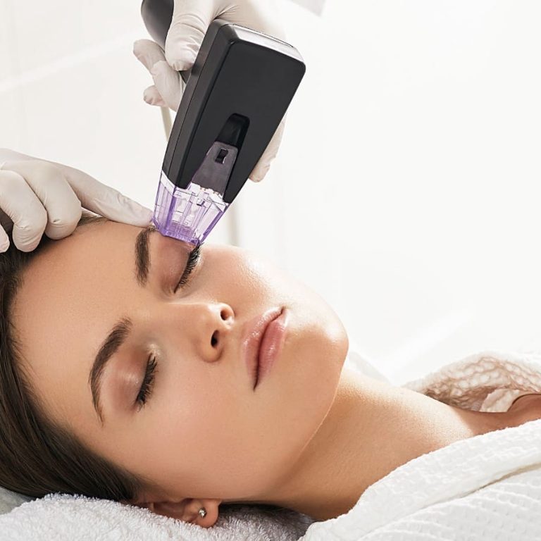 Morpheus8: The Skin Tightening Secret Celebrities Swear By