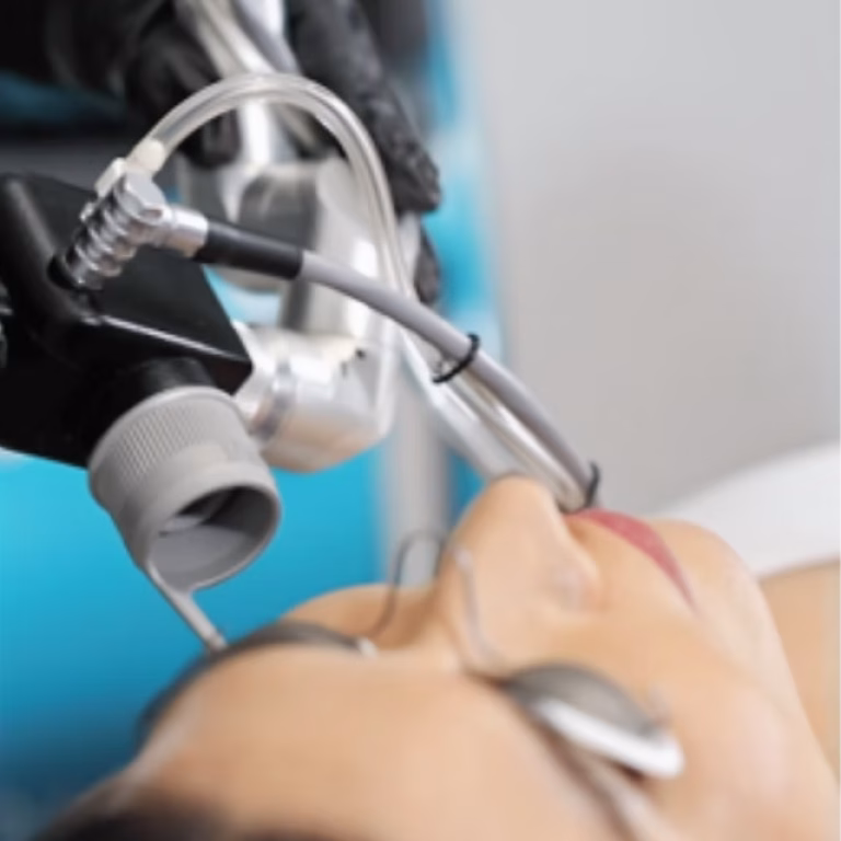 solaria laser4